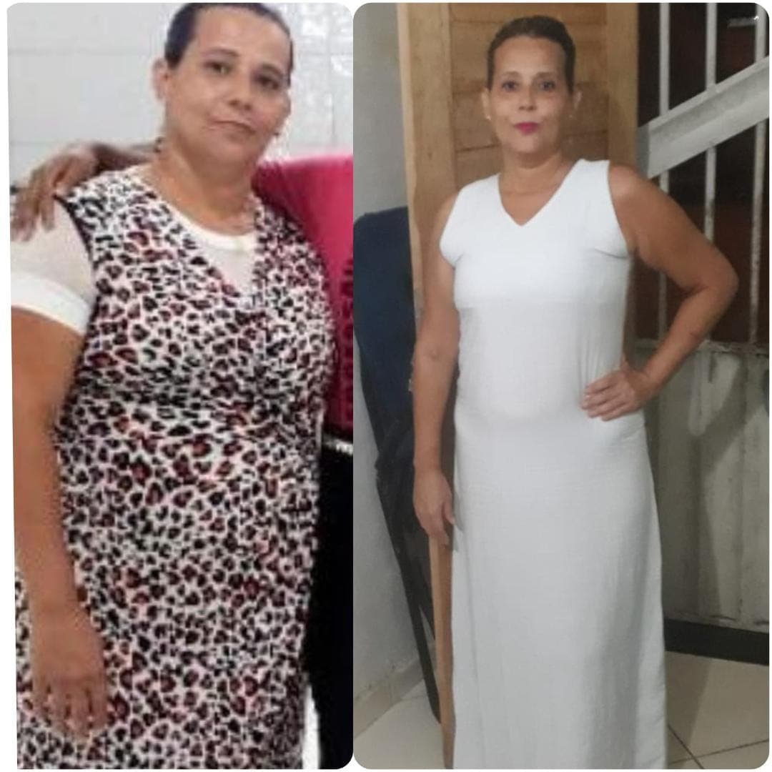 Evolução visual de acompanhamento, registro de corpo inteiro